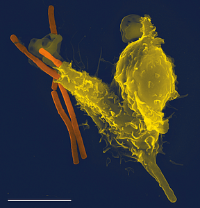      A scanning electron microscope image of a single neutrophil (yellow), engulfing anthrax bacteria        (orange)
